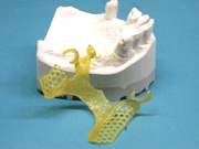 Ti-Light pattern after light curing, removed from model